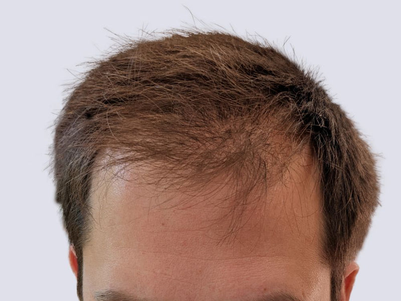 Thinning hair before applying Nut Job