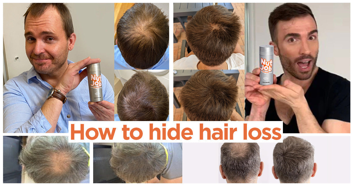 How To Hide Hair Loss At The Crown with Pictures