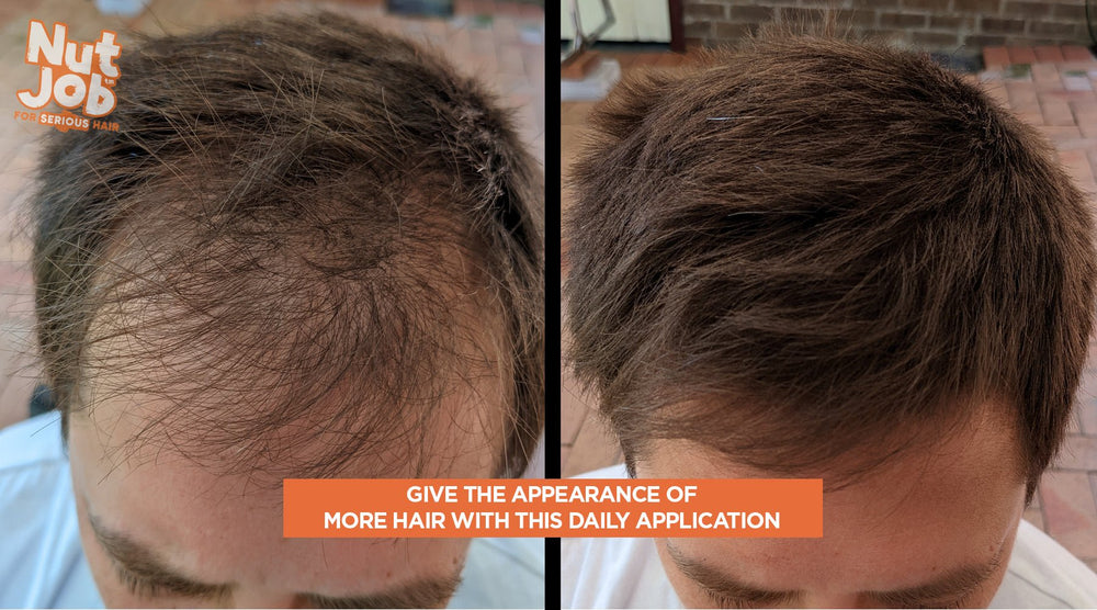 glutathione and hair loss can cause L-glutathione VS Glutamine: Which Is Better to Take? Glutathione for Hair Health: Myth