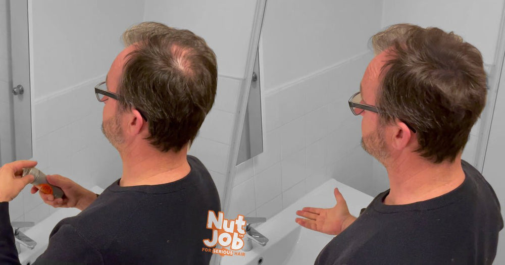 Best Treatment for Hair Loss in Men - Nut Job Hair Building Fibres