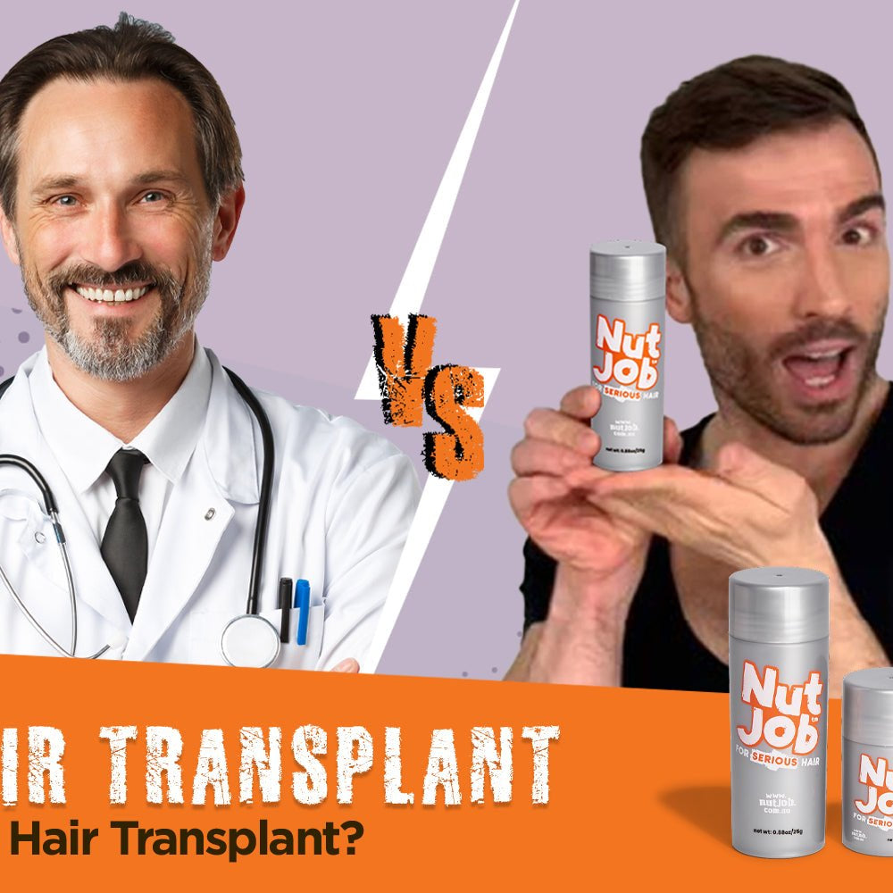 Hair Transplant Before and After vs Hair Fibres - Nut Job Hair Building Fibres