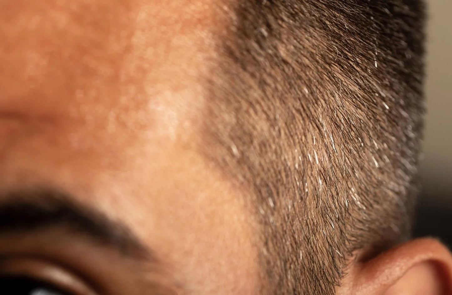 How Long Does Hair Growth Really Take? - Nut Job Hair Building Fibres