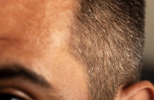 How Long Does Hair Growth Really Take? - Nut Job Hair Building Fibres