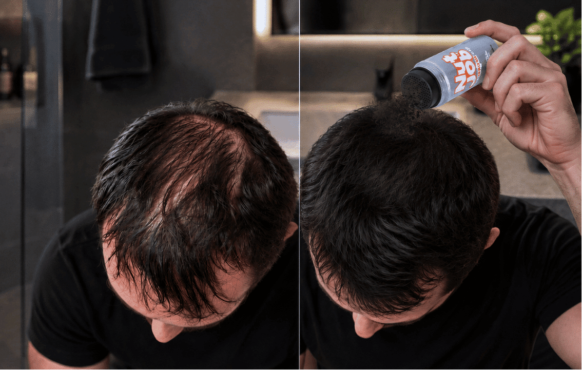 How To Hide and Fix Hair Loss At The Crown Instantly - Nut Job Hair Building Fibres