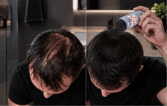 How To Hide and Fix Hair Loss At The Crown Instantly - Nut Job Hair Building Fibres