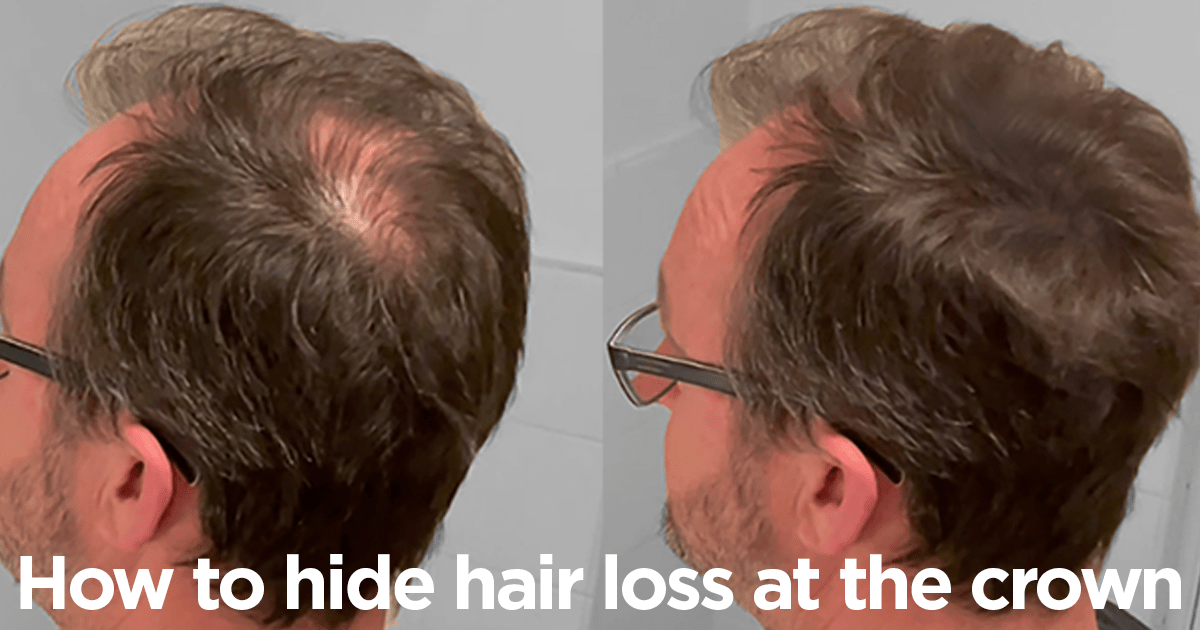 How To Hide and Fix Hair Loss At The Crown Instantly - Nut Job Hair Building Fibres