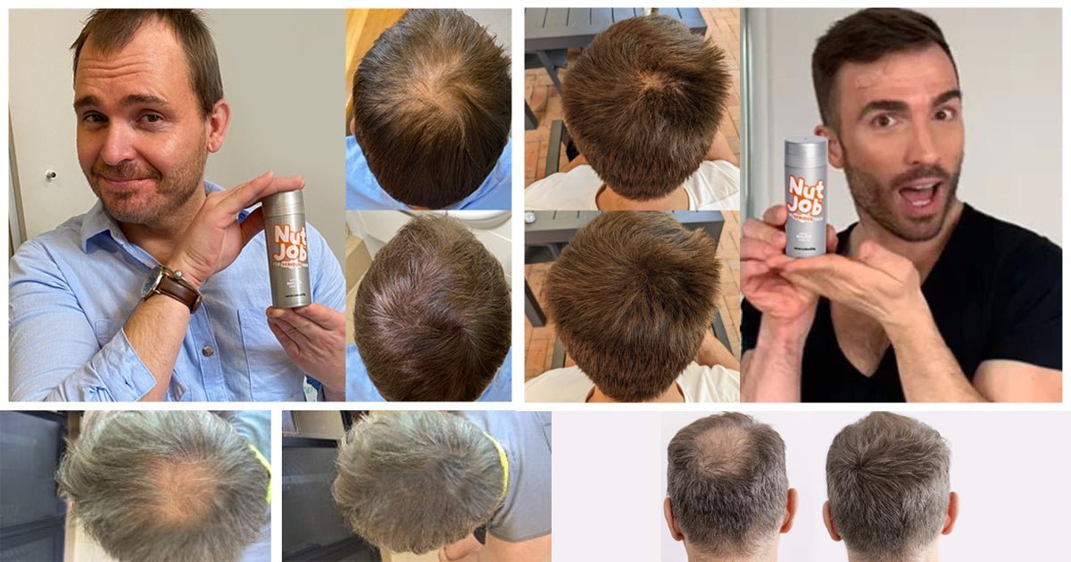 How To Hide Hair Loss At The Crown with Pictures - Nut Job Hair Building Fibres