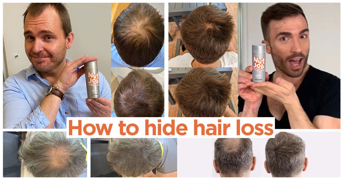 How To Hide Hair Loss At The Crown with Pictures - Nut Job Hair Building Fibres