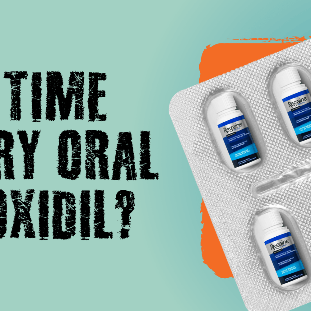 Oral Minoxidil: Can It Boost Hair Growth Better Than Topical Treatments? - Nut Job Hair Building Fibres