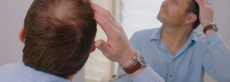 Man with thinning hair on his crown touching his hair in front of a bathroom mirror