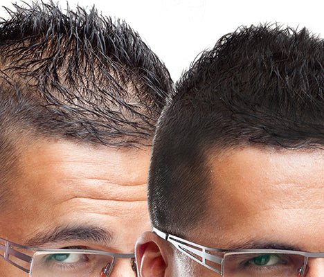 Hair loss cover up starter pack. Hide balding crown with shake on fibres plus waterproof concealer. - Nut Job