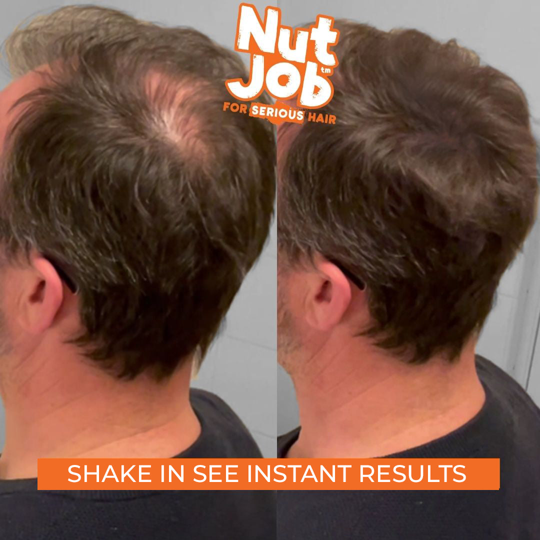 Rear view of a man's crown side by side, thinning on the left and fuller-looking on the right, with the Nut Job logo