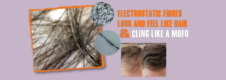 Lilac banner with a close-up of hair strands, two magnified fibre circles and a thinning and fuller hairline side by side