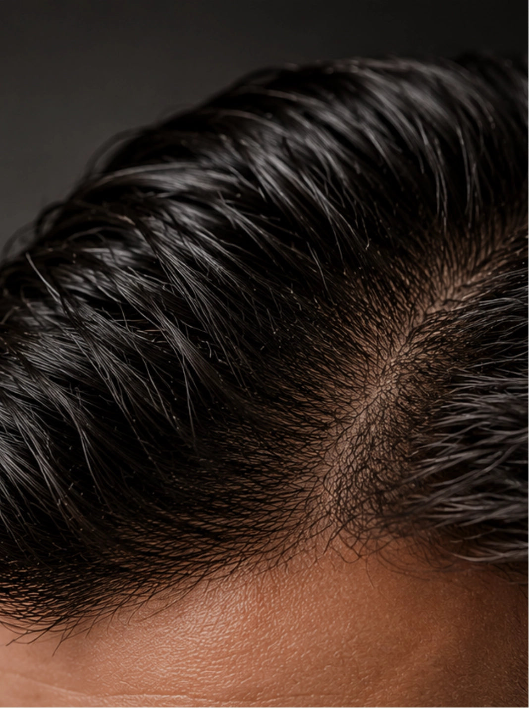 Close-up of fine dark hair over a thinning patch of scalp near the hairline