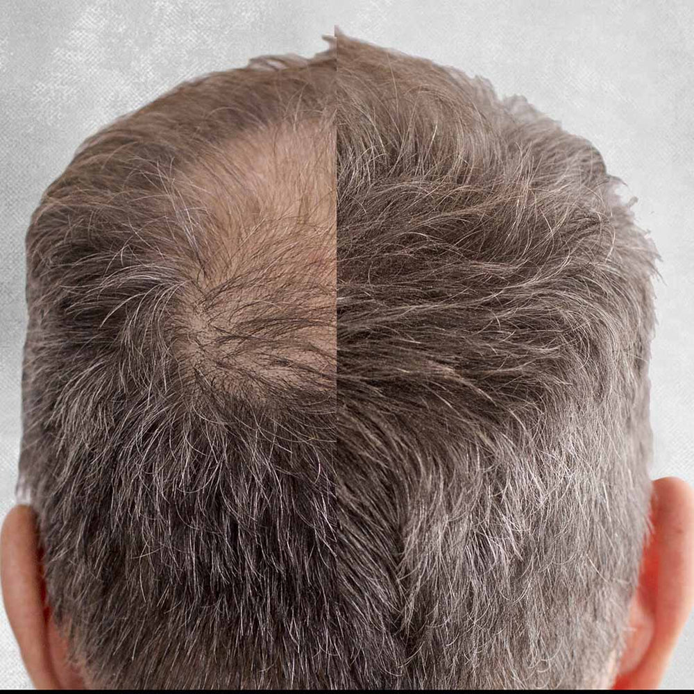 Hair Building Fibres for Hair Loss 25g - Nut Job Hair Building Fibres