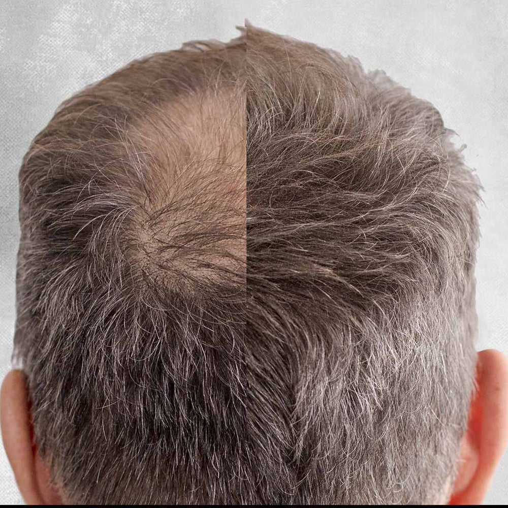 
                  
                    before and after hair loss image
                  
                