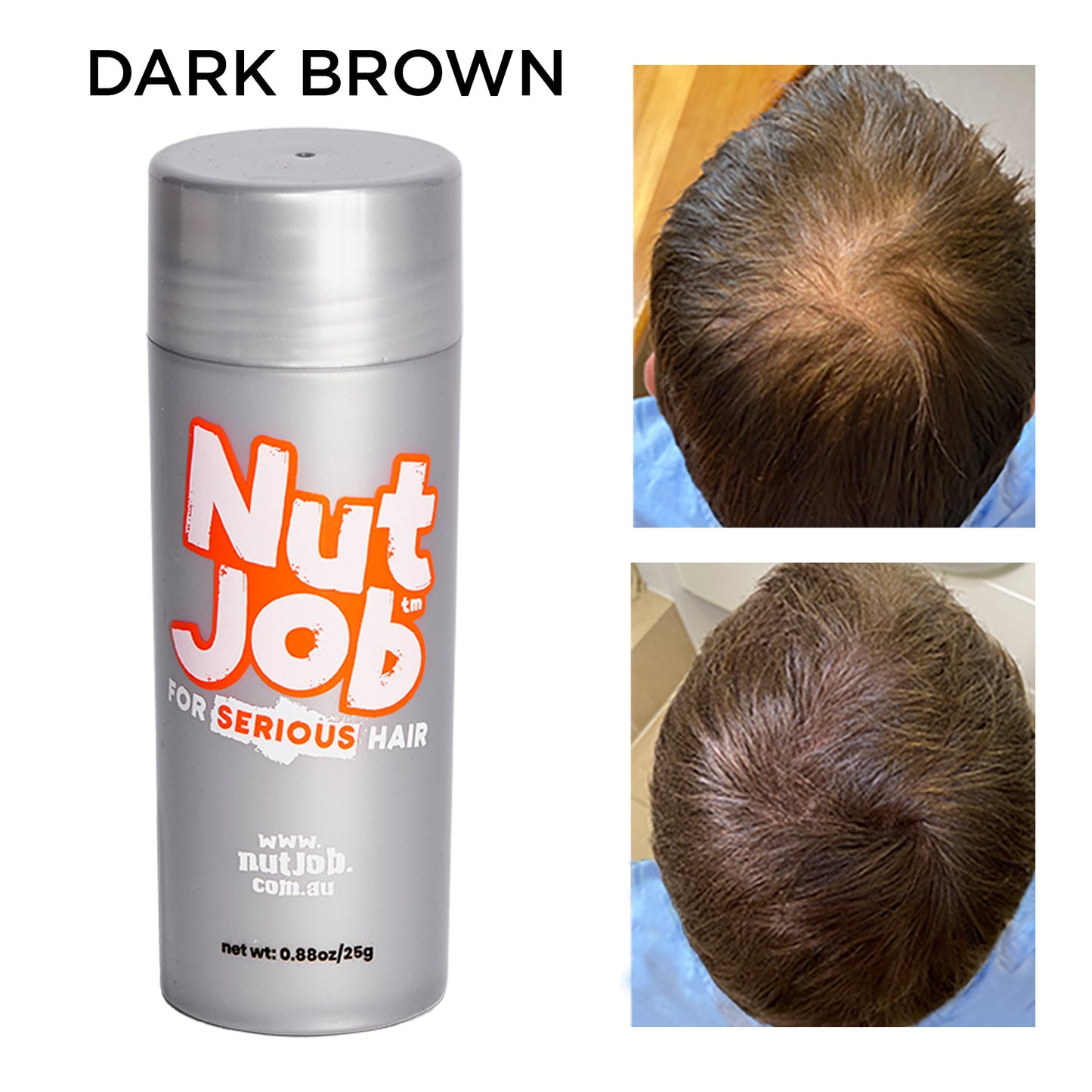 
                      
                        Hair Thickening Fibres for Hair Loss 25g - Nut Job Hair Building FibresDark Brown
                      
                    