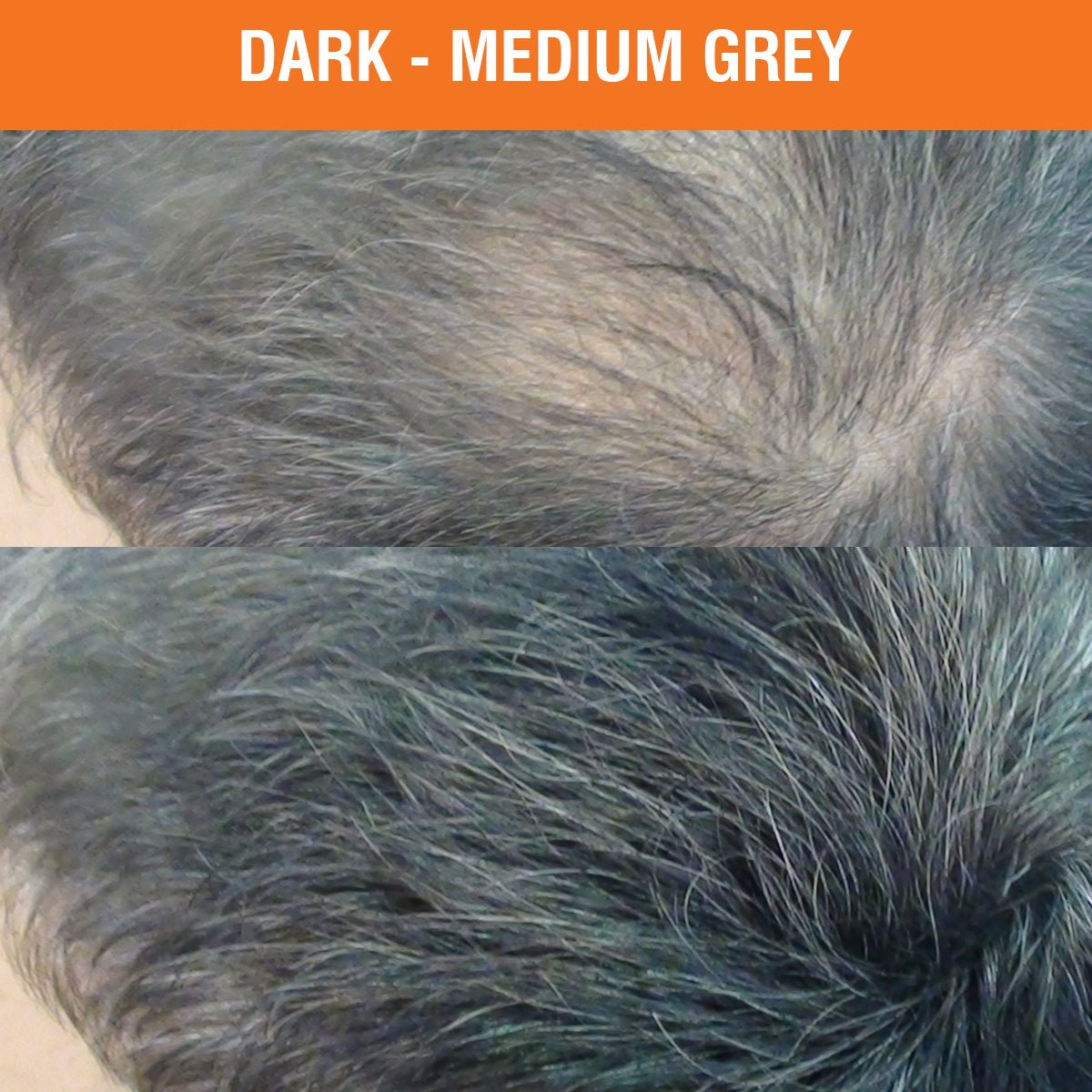 
                      
                        Hair Thickening Fibres for Hair Loss 25g - Nut Job Hair Building FibresMedium / Dark Grey
                      
                    