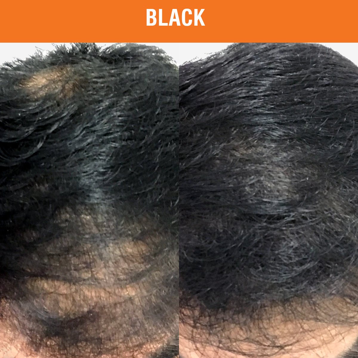 
                      
                        Hair Thickening Fibres for Hair Loss 25g - Nut Job Hair Building FibresBlack
                      
                    