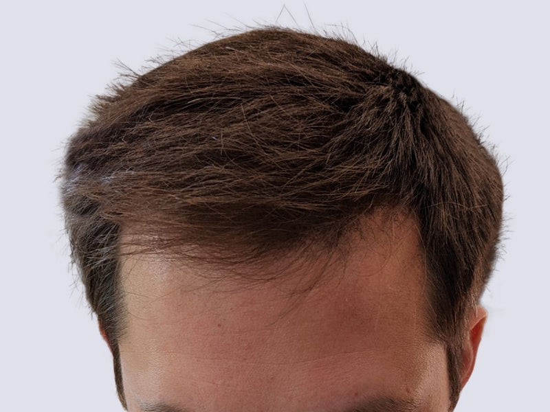 Fuller-looking hair after applying Nut Job