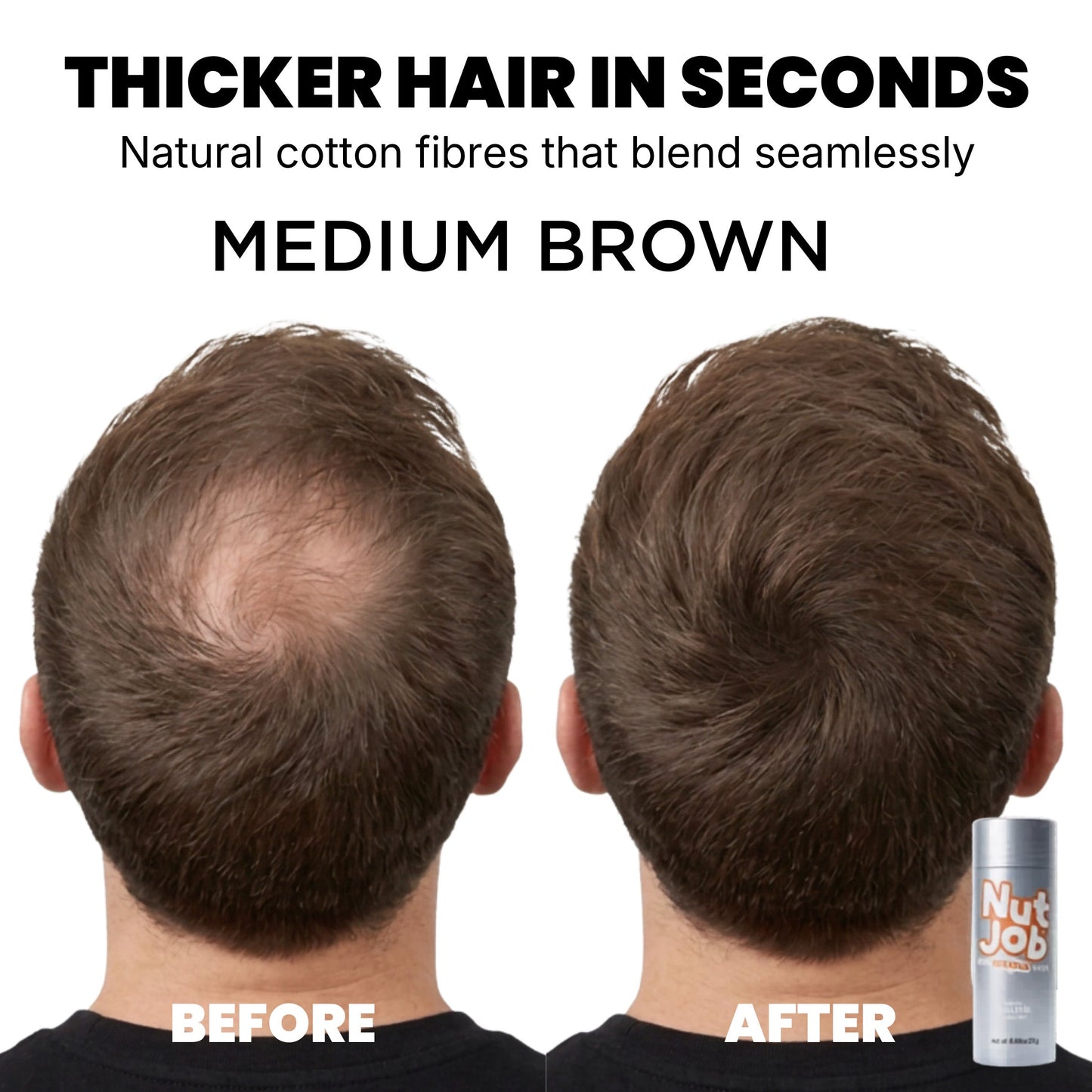 
                      
                        Hair Thickening Fibres for Hair Loss
                      
                    